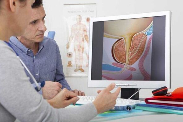 el médico consulta al paciente sobre el tema de la prostatitis