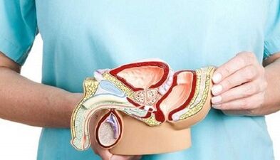 Cómo tratar la prostatitis en los hombres