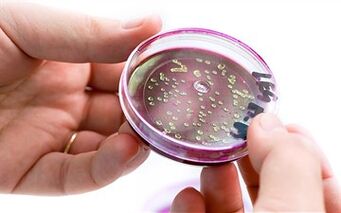 Bacterias en la secreción de la próstata.